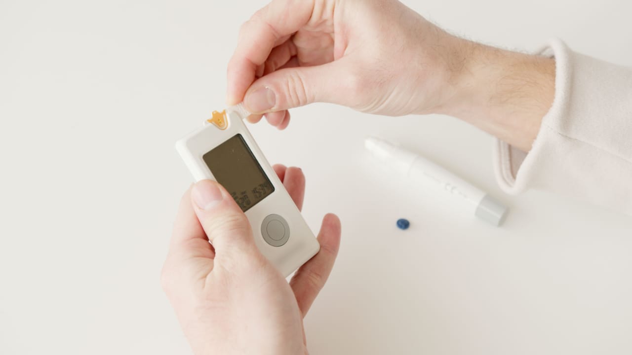 CGM